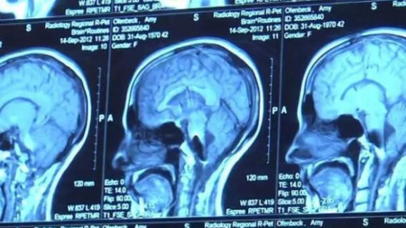 vezi cele mai bizare cazuri medicale