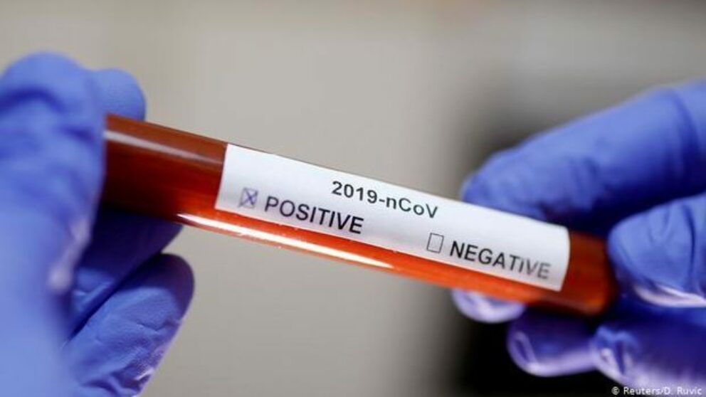 coronavirus