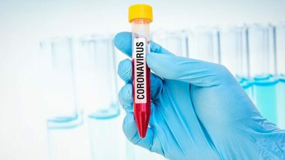 coronavirus