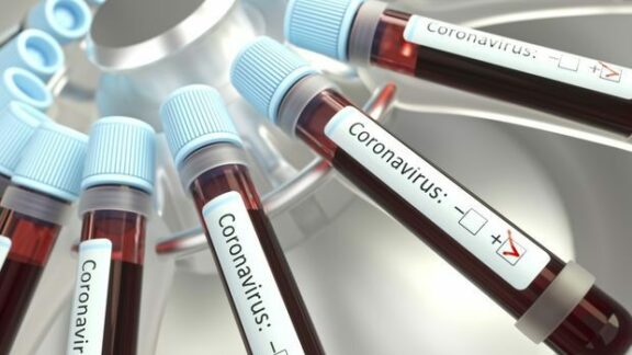 coronavirus
