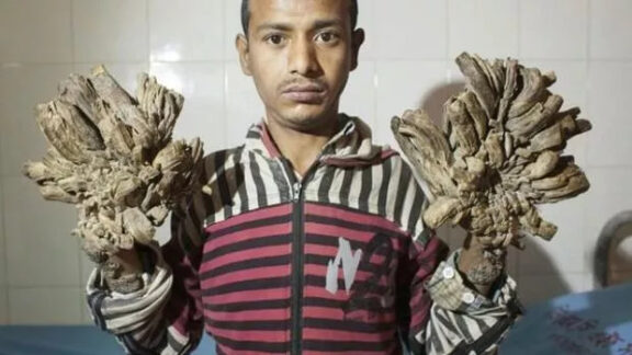 sursa:cunoastelumea.ro