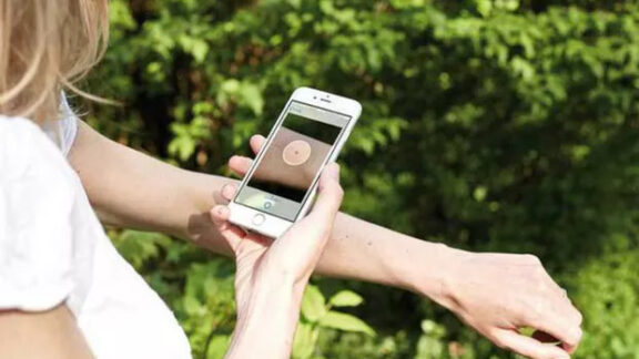 Aplicaţia ce identifică cancerul de piele