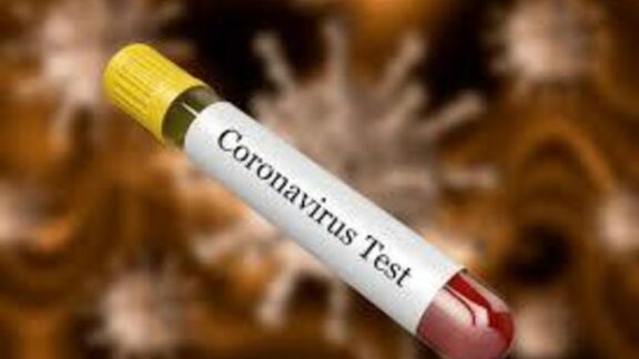 Noi date privind COVID-19 în R.Moldova