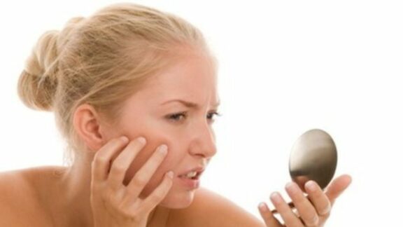 Puncte negre pe față