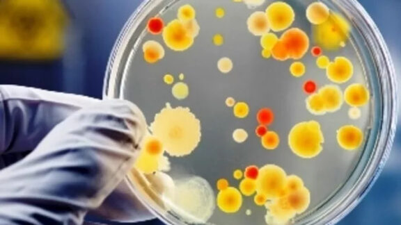 Virusul rujeola la microscop